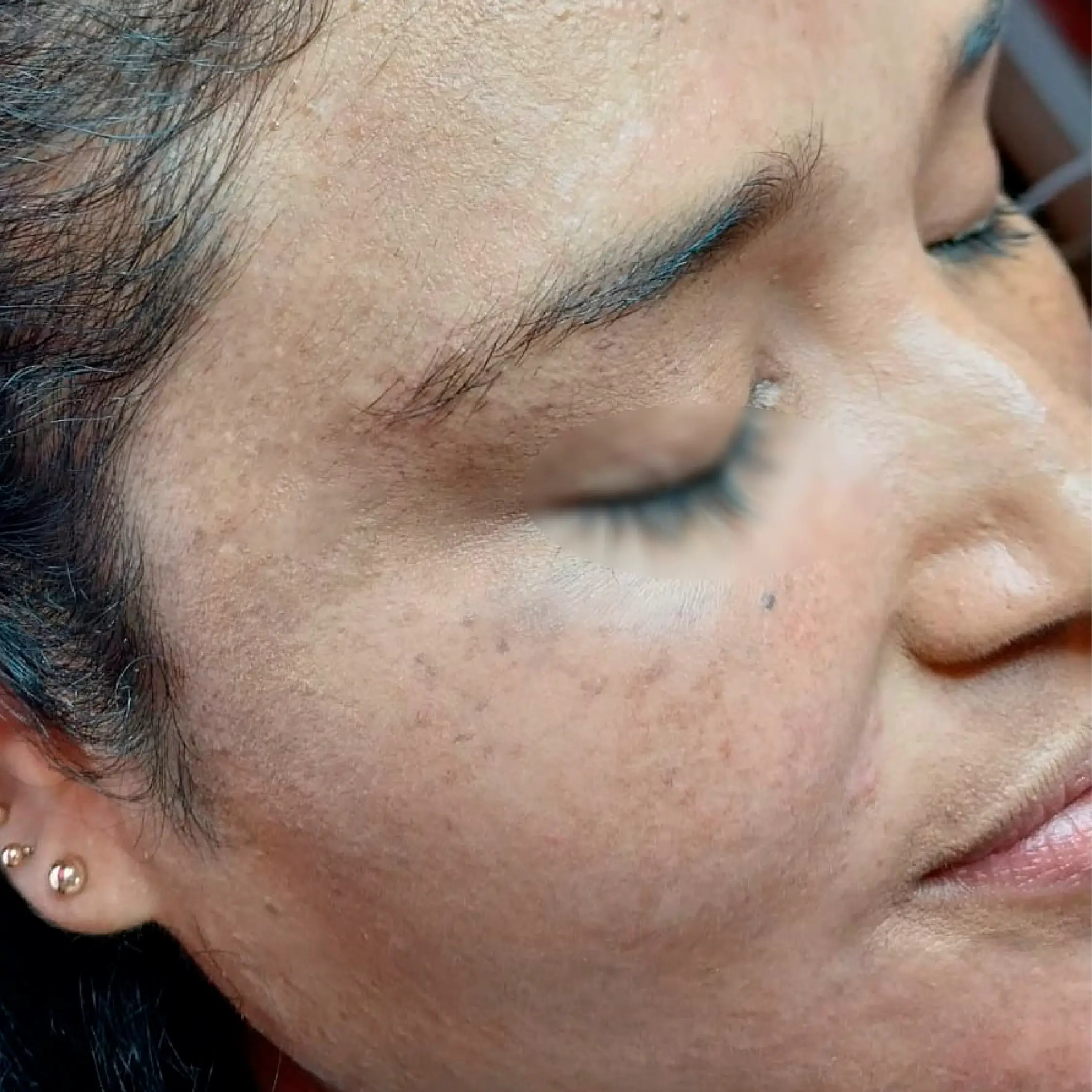 Después - Proyecto 4